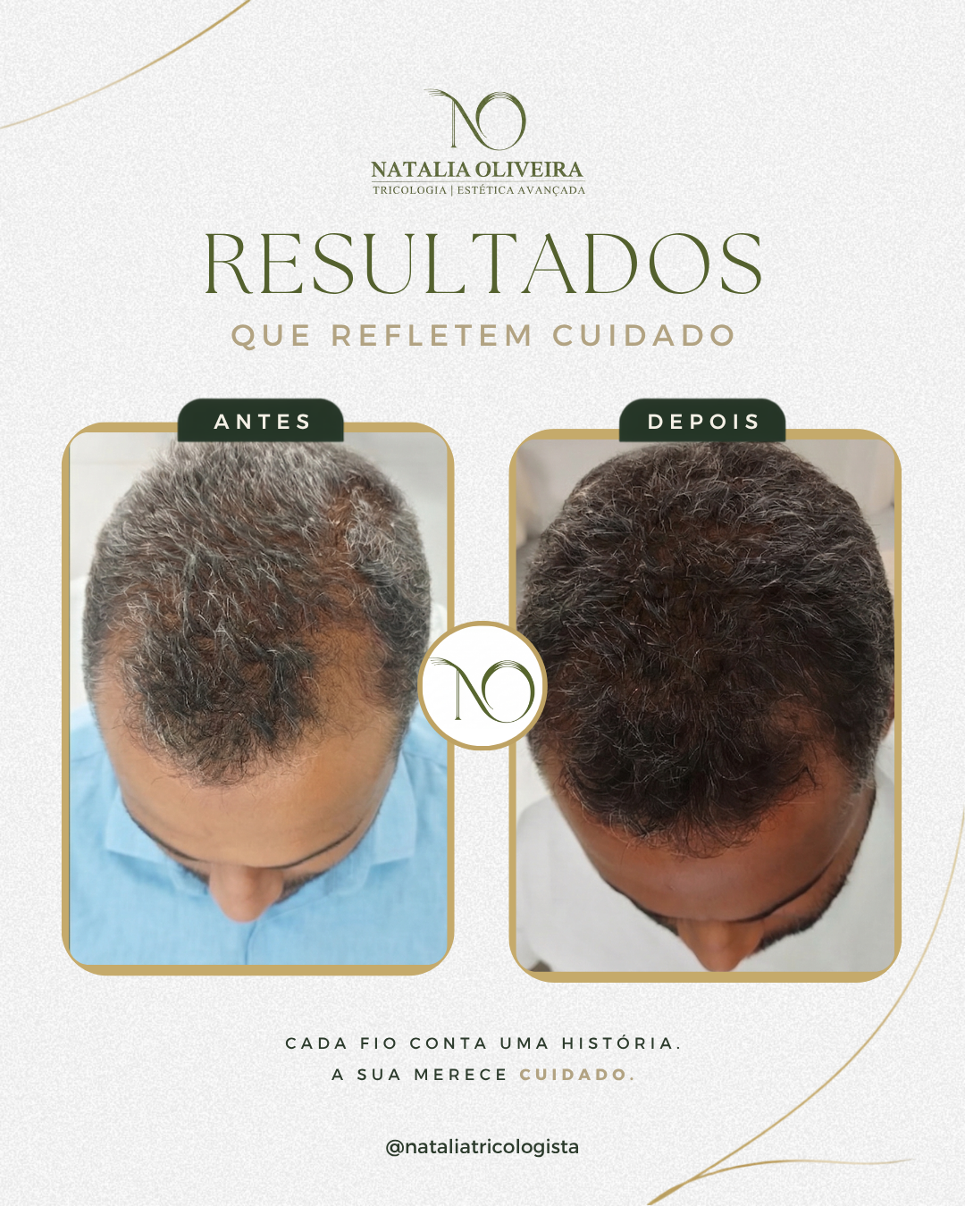 Resultado de antes e depois do acompanhamento capilar