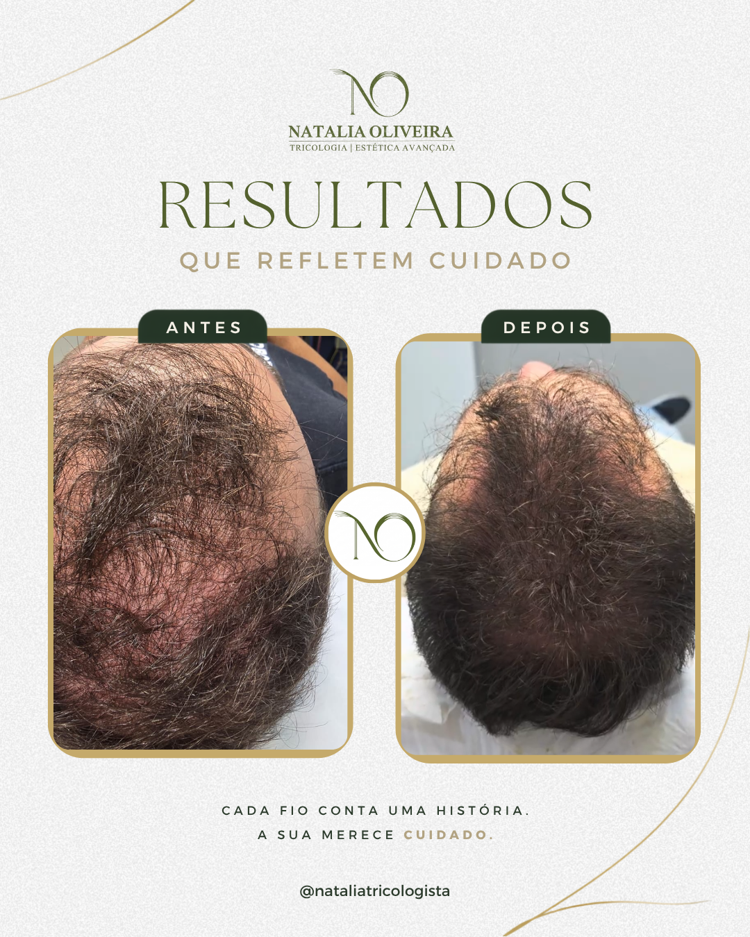 Resultado de antes e depois do acompanhamento capilar
