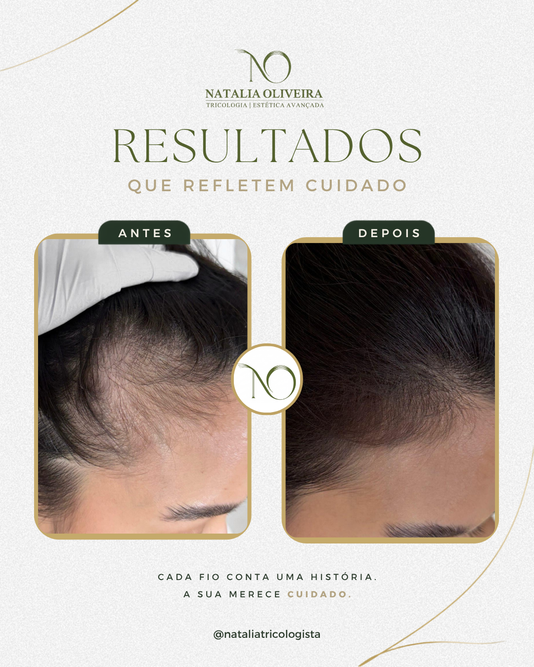 Resultado de antes e depois do acompanhamento capilar