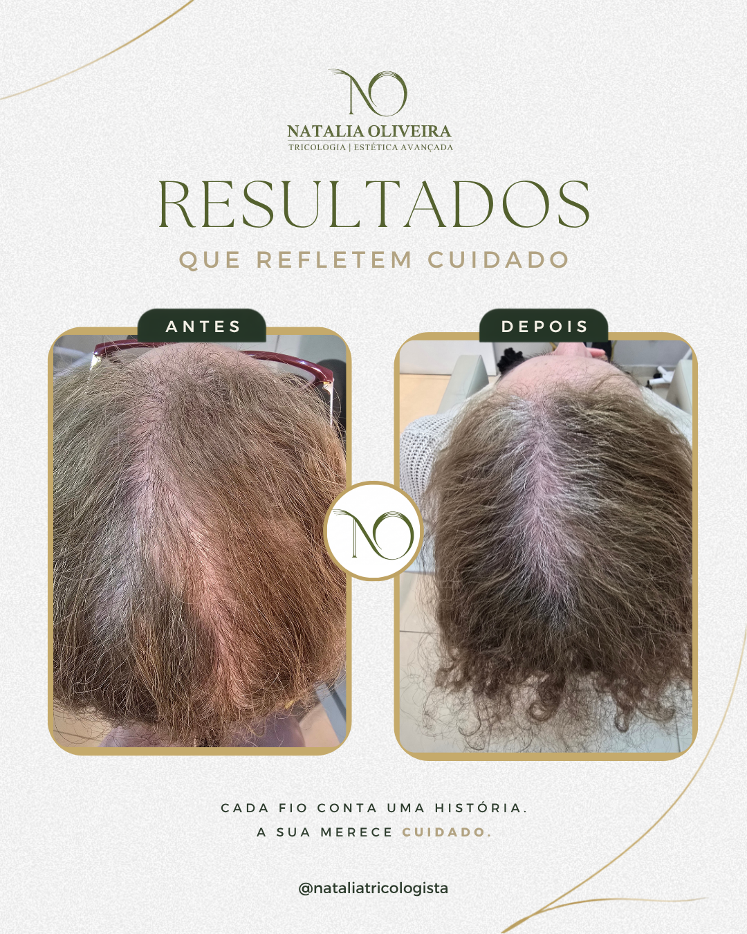 Resultado de antes e depois do acompanhamento capilar