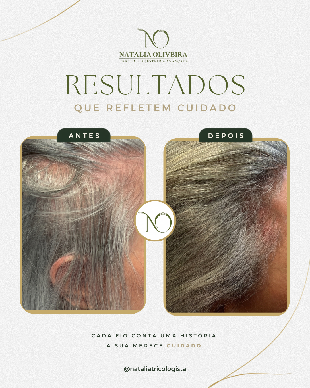 Resultado de antes e depois do acompanhamento capilar