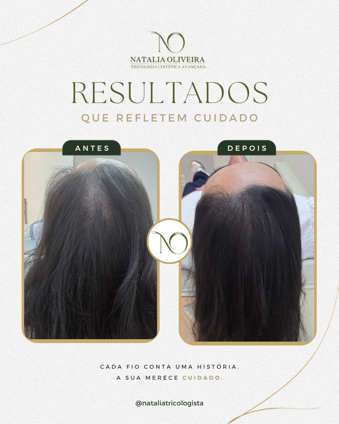 Resultado de antes e depois do acompanhamento capilar